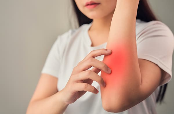 Inflammation in Arm